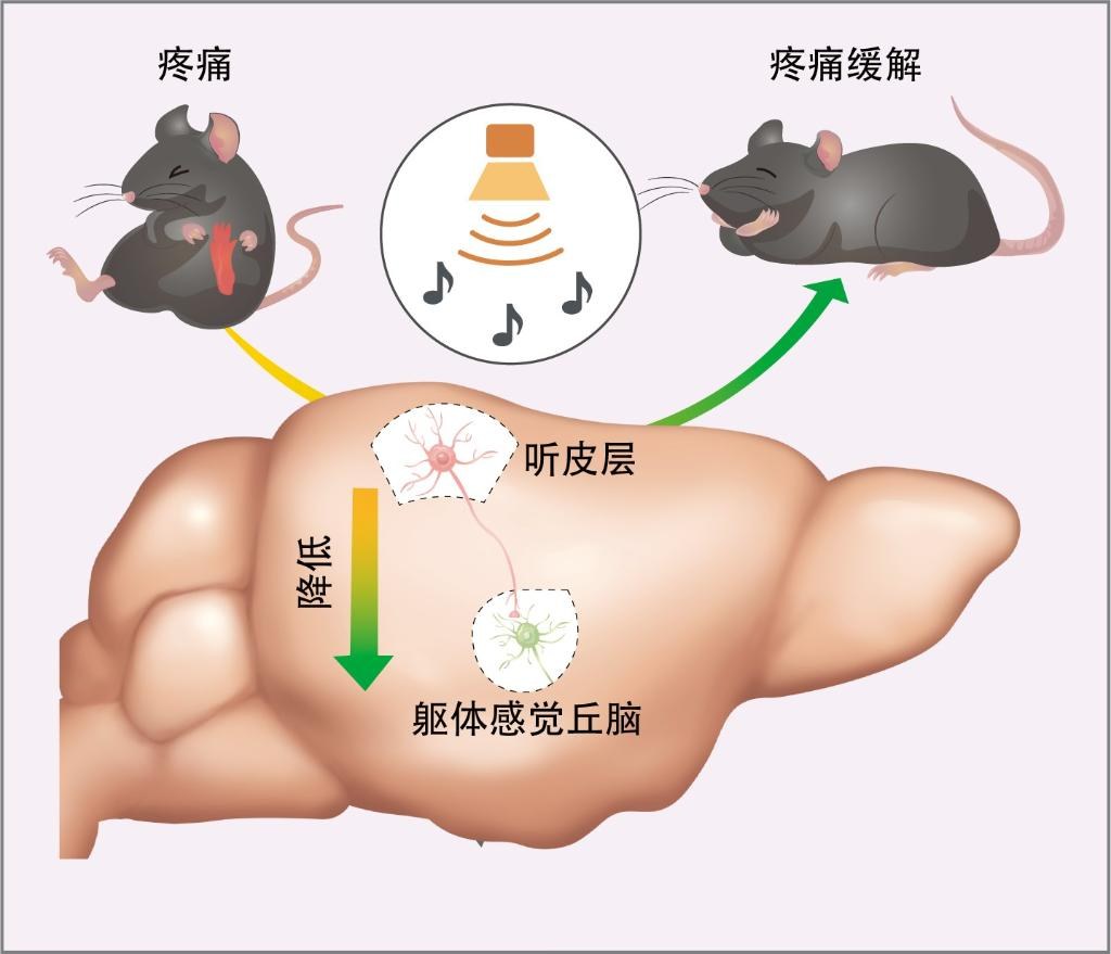 中科大科研团队发现“声音能镇痛”的科学机制